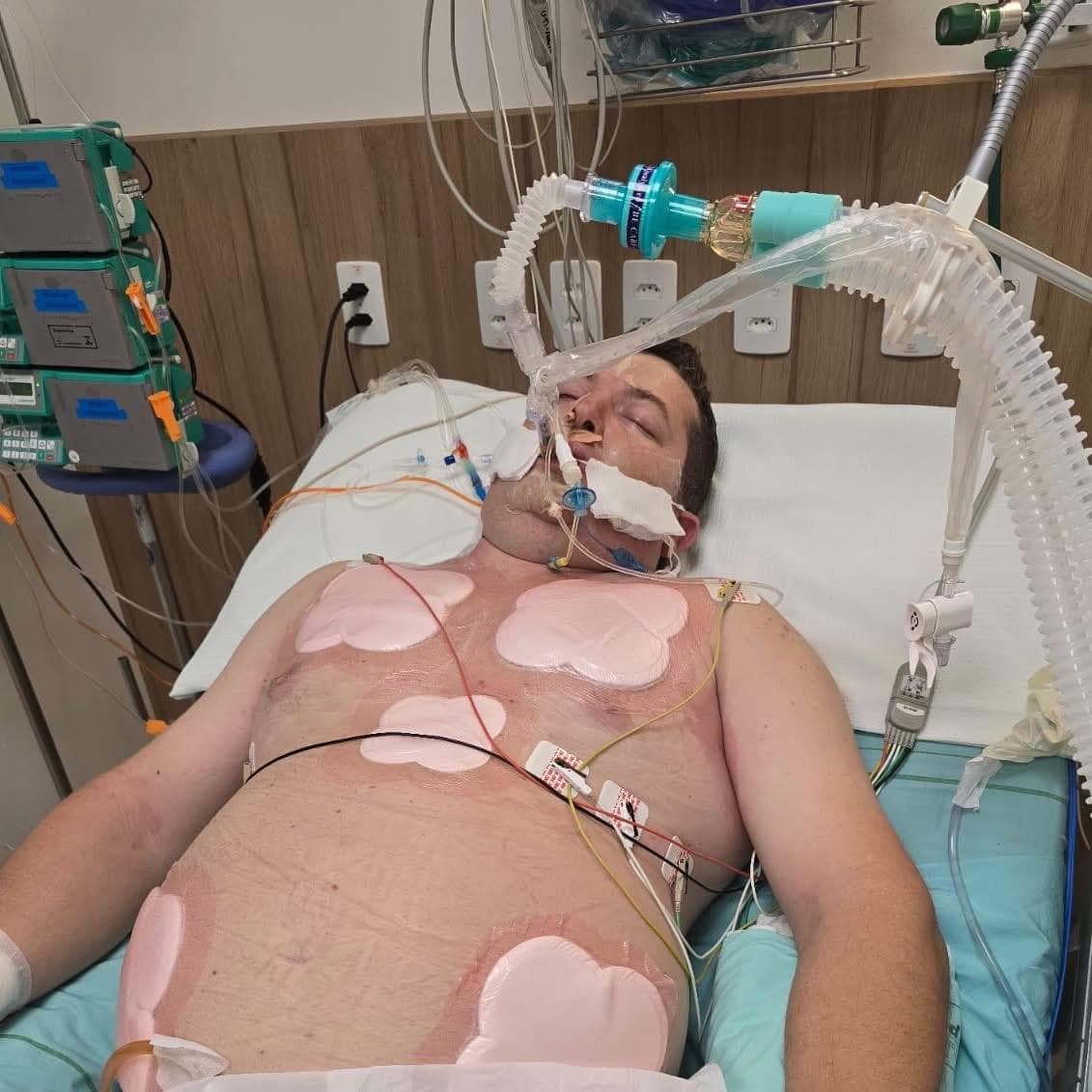 Cada segundo conta: morador de Palmitos luta contra H1N1 em UTI