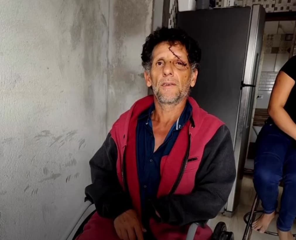 Família ferida em perseguição na BR-282 precisa de ajuda