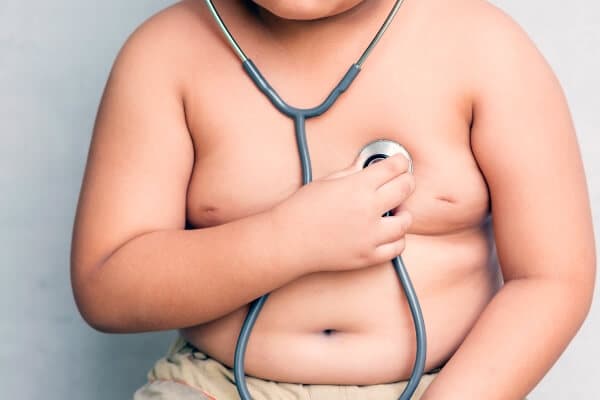 Santa Catarina tem índices de obesidade infantil acima da média do país