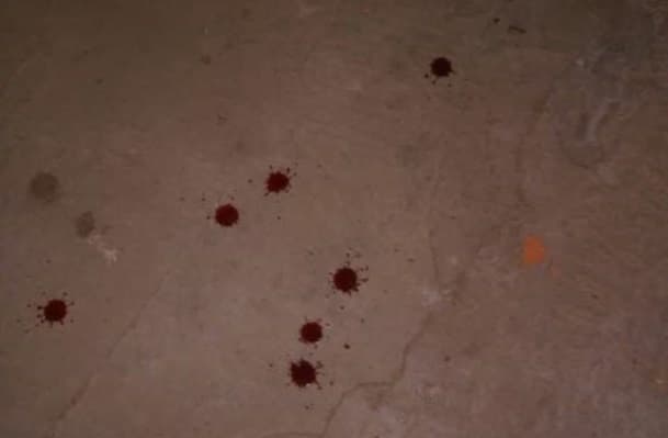 Vítima apresentava sangramento e palidez (Foto: Ilustração)